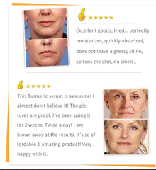 Beauty Lights Turmeric Serum