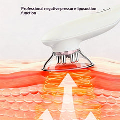 Negative-Pressure Liposuction Body-Shaping Red-Light Beauty And Weight-Loss Device